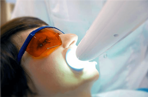 Understanding the Causes of Teeth Sensitivity Barnsley