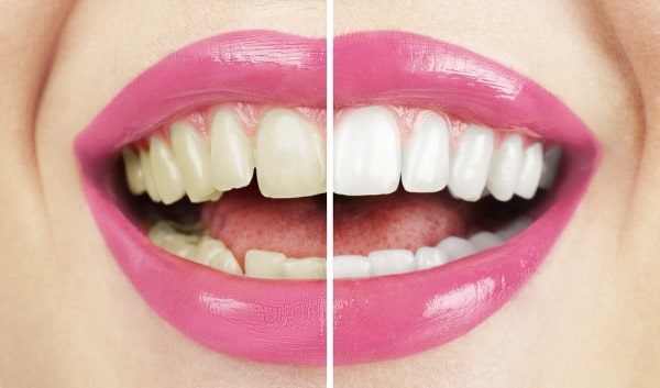 What Early Signs of Oral Cancer Should You Never Ignore Barnsley?