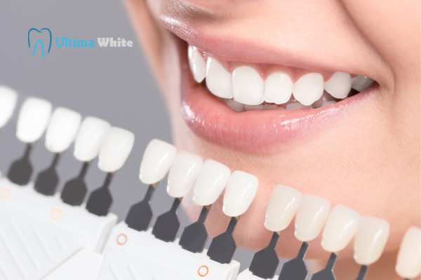 How to Maximise the Results of Your Laser Teeth Whitening Treatment Barnsley