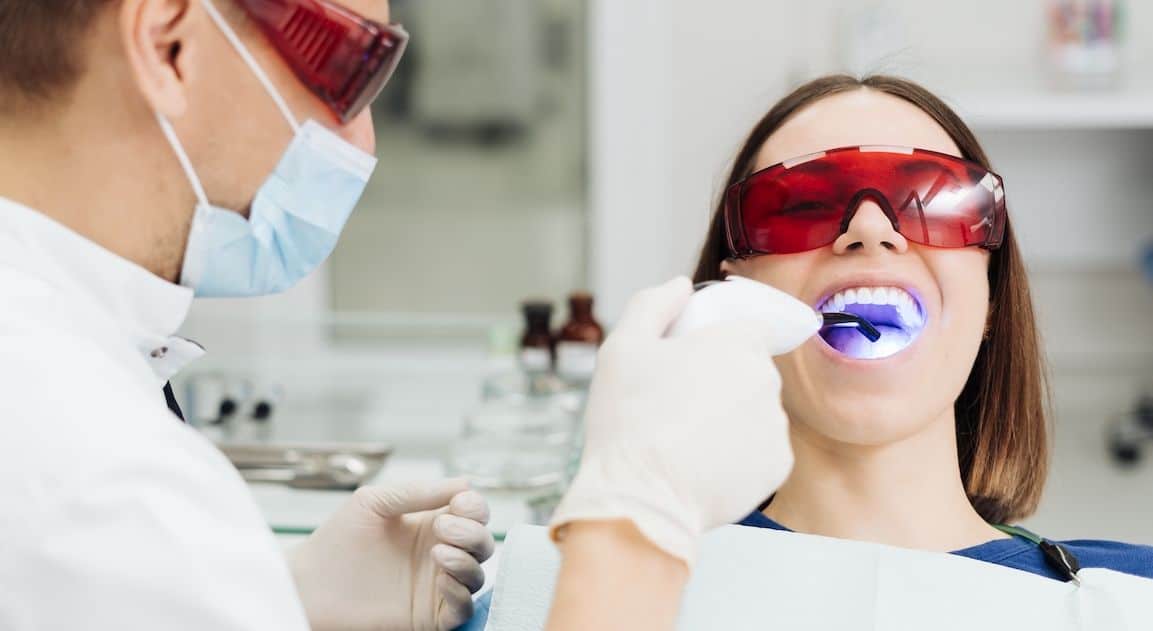 Do Dental Crowns Change Colour After Teeth Whitening Barnsley?