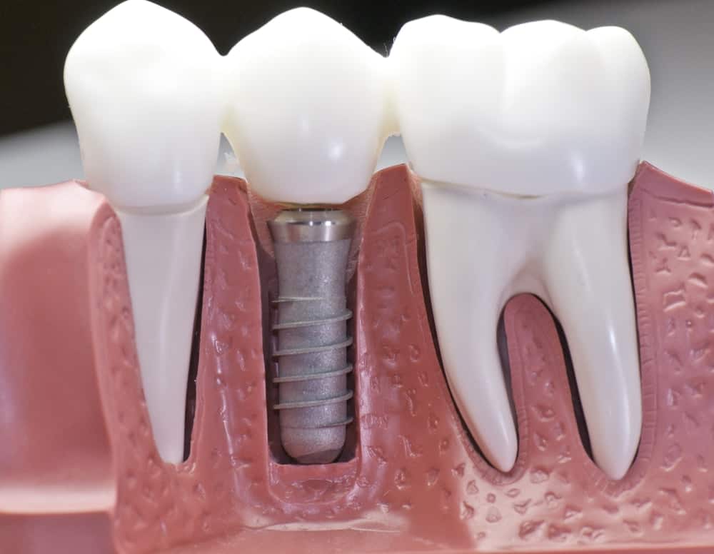 Common Misconceptions About Modern Dental Treatments Barnsley