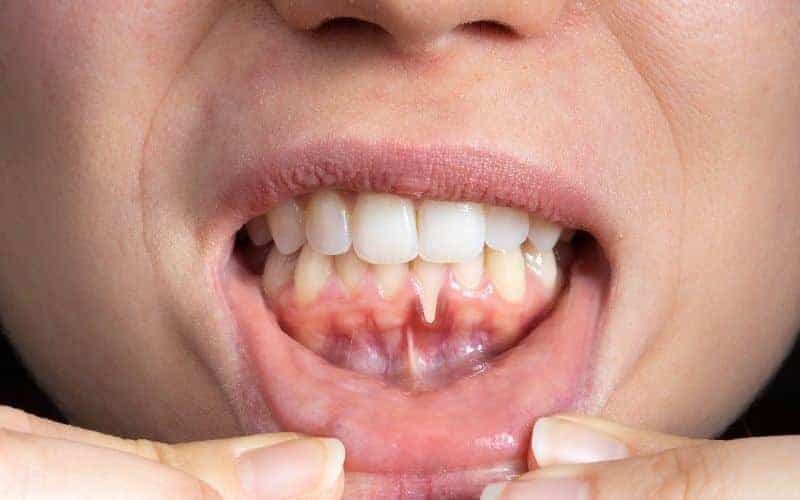 Final Thoughts: Building Lifelong Enamel Protection Habits Barnsley