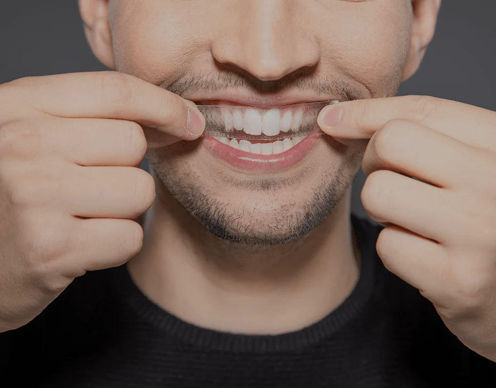 How Are Invisible Aligners Changing Orthodontic Treatments Barnsley?
