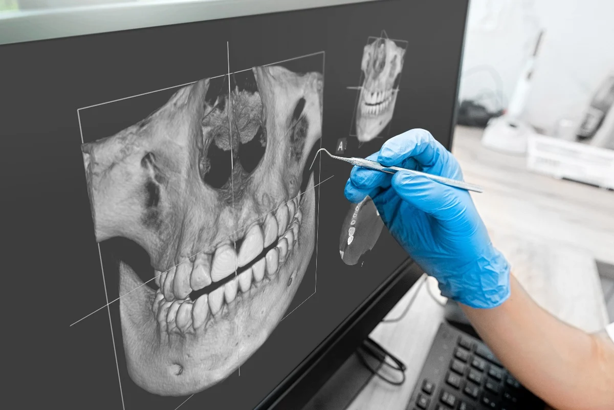 Key Benefits of 3D Printing for Patients and Dentists Barnsley