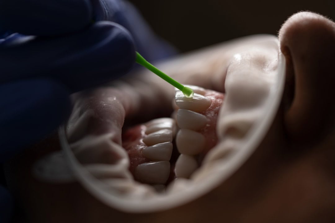 How Saliva Protects Your Teeth and Gums Barnsley