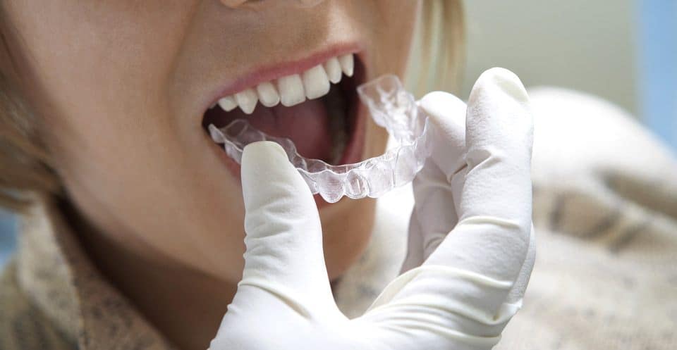 Can Bruxism Affect Your Sleep Quality Barnsley