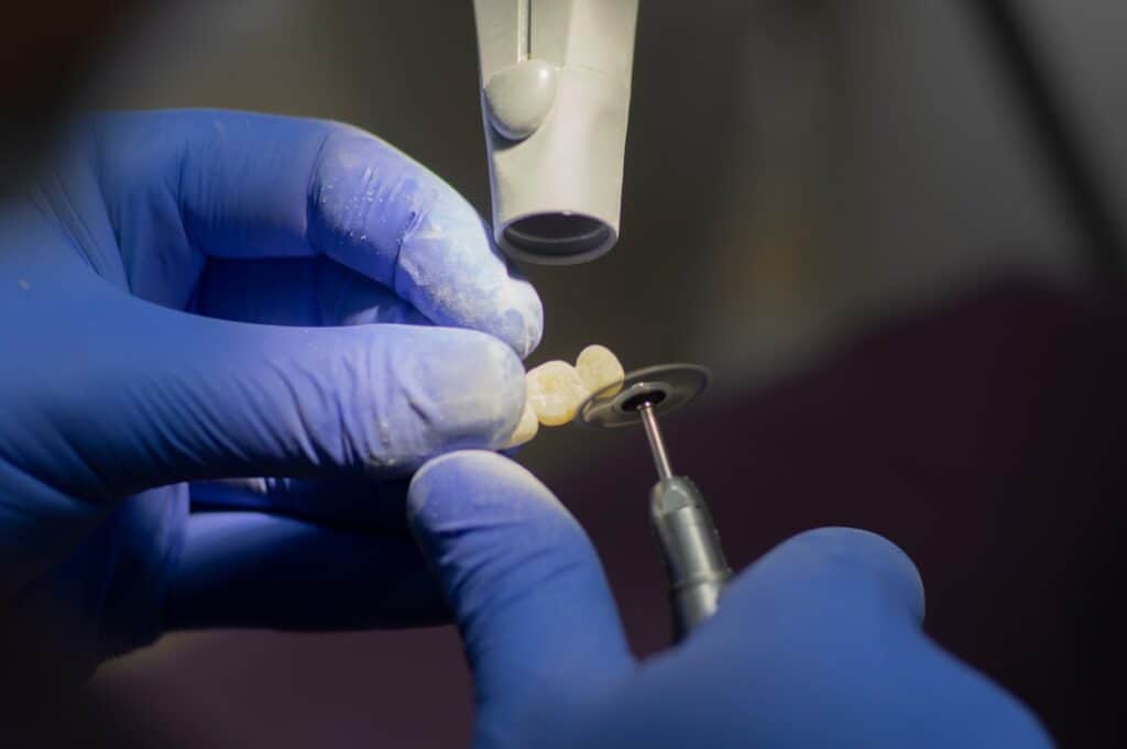 Customised Dental Solutions: Crowns, Aligners, and Implants Barnsley