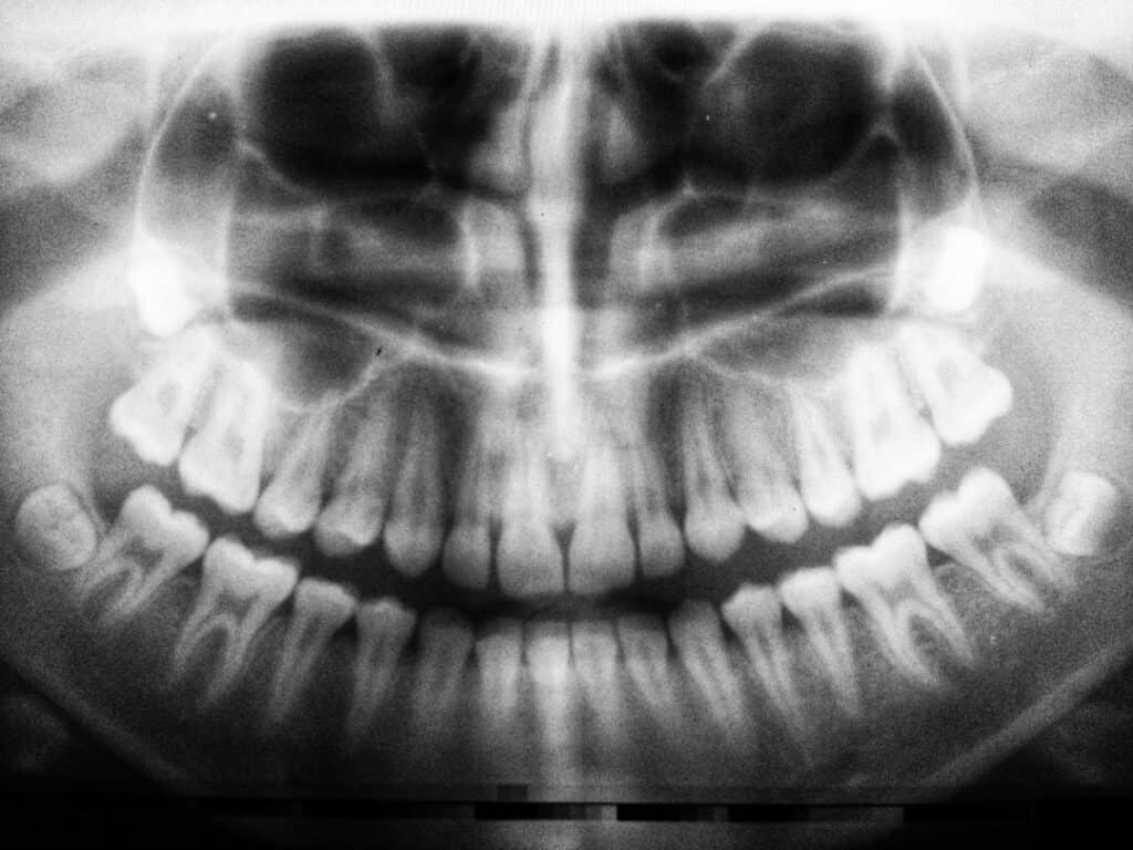 The Future of 3D Printing in Oral Healthcare Barnsley